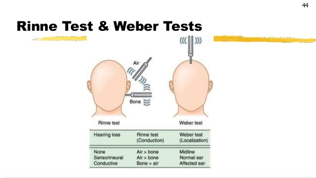 Rinne Weber Rinnes And Webers Tests