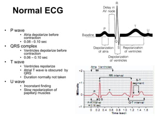 Normal ECG P wave Atria depolarize before contraction 0.08 - 0.10 sec QRS complex Ventricles depolarize before contraction 0.06 – 0.10 sec T wave Ventricles repolarize Atrial T wave is obscured  by QRS Duration normally not taken U wave Inconstant finding Slow repolarization of papillary muscles 