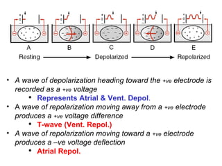 A wave of depolarization heading toward the  +ve  electrode is recorded as a  +ve  voltage Represents Atrial & Vent. Depol . A  wave of repolarization moving away from a  +ve  electrode produces a  +ve  voltage difference T-wave (Vent. Repol.)   A wave of repolarization moving toward a  +ve  electrode produces a –ve voltage deflection Atrial Repol. 