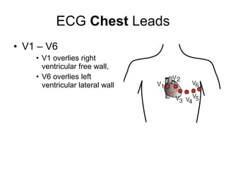 ECG  Chest  Leads V1 – V6 V1 overlies right ventricular free wall,  V6 overlies left ventricular lateral wall 