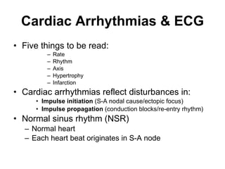 Cardiac Arrhythmias & ECG Five things to be read: Rate Rhythm Axis Hypertrophy Infarction Cardiac arrhythmias reflect disturbances in: Impulse initiation  (S-A nodal cause/ectopic focus) Impulse propagation  (conduction blocks/re-entry rhythm)  Normal sinus rhythm (NSR) Normal heart Each heart beat originates in S-A node 