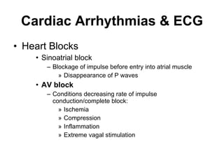 Cardiac Arrhythmias & ECG Heart Blocks Sinoatrial block Blockage of impulse before entry into atrial muscle Disappearance of P waves AV block Conditions decreasing rate of impulse conduction/complete block: Ischemia Compression Inflammation Extreme vagal stimulation 