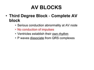 AV BLOCKS Third Degree Block  -  Complete AV block Serious conduction abnormality at AV node No conduction of impulses   Ventricles establish their  own rhythm   P waves  dissociate  from QRS complexes 