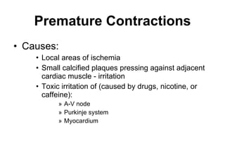 Premature Contractions Causes: Local areas of ischemia Small calcified plaques pressing against adjacent cardiac muscle - irritation Toxic irritation of (caused by drugs, nicotine, or caffeine): A-V node  Purkinje system Myocardium 