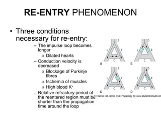 RE-ENTRY  PHENOMENON Three conditions necessary for re-entry: The impulse loop becomes longer Dilated hearts Conduction velocity is decreased Blockage of Purkinje fibres Ischemia of muscles High blood K + Relative refractory period of the reentered region must be shorter than the propagation time around the loop  