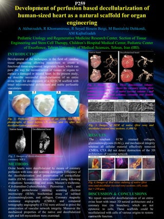 Development of perfusion based decellularization of
human-sized heart as a natural scaffold for organ
engineering
A Akbarzadeh, R Khorramirouz, R Seyed Hosein Beigi, M Banitalebi Dehkordi,
AM Kajbafzadeh
Pediatric Urology and Regenerative Medicine Research Center, Section of Tissue
Engineering and Stem Cell Therapy, Children’s Hospital Medical Center, Pediatric Center
of Excellence, Tehran University of Medical Sciences, Tehran, Iran (IRI).
INTRODUCTION
Development of the techniques in the field of cardiac
tissue engineering allowing researchers to create a
functional tissue-engineered large-scale heart, which can
pave the way for reconstruction of tissues or organs to
replace a damaged or injured heart. In the present study,
we describe successful decellularization of an entire
ovine heart for development of a 3D ECM scaffold with
intact microstructural architecture and stable perfusable
vasculature.
Fig. 1. Perfusion decellularization of an ovine heart; (1)
photographs of heart before, (2) during, and (3) after the
decellularization procedure
Fig. 3. Images of CTA. Three dimensional volume-
rendered reconstruction shows the coronary system (first
column), coronary tree of native (second column ) and
coronary system (third column), coronary tree (fourth
column)of decellular heart.
METHODS
Ovine hearts were decellularized by means of coronary
perfusion with ionic and nonionic detergents. Efficiency of
the decellularization and preservation of extracellular
matrix (ECM) components were assessed using following
evaluations: hematoxiline and eosin, Masson’s trichrome,
4′,6-diamidino-2-phenylindole, Picrosirius red, and
Movat’s pentachrome staining; scanning electron
microscopy (SEM); biochemical assay of sulfated
glycosaminoglycans, and collagen. Coronary magnetic
resonance angiography (CMRA) and computed
tomography angiography (CTA) were utilized to prove the
preservation of vascular network integrity. Moreover the
mechanical properties of the native and decellularized
right and left myocardium were examined.
Fig. 3. Images of SEM of native (first row) and
decellular (second row) sections. (1,000 X)
RESULTS
The resultant ECM retained collagen,
glycosaminoglycans (GAGs), and mechanical integrity
whereas all cellular material effectively removed
.CMRA, CTA did not detect destruction of the 3D
architecture of vascular network .
DISCUSSION & CONCLUSIONS
We report successful decellularization of an entire
ovine heart with intact 3D natural architecture and a
coronary tree (its branches), which are not
cytotoxic to cells. These scaffolds could be
recellularized with cells of various origins to restore
contractile function.
Fig. 4. Images of Red sirius staining of native (first
row) and decellular (second row) sections. (4X, scale
bar = 250 μm).
Fig. 2. Images of three-dimensional whole-heart
coronary MRA
P259
 