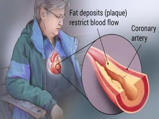 Heart Anatomy & Basic Function