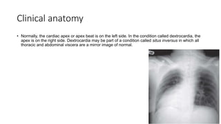 Clinical anatomy
• Normally, the cardiac apex or apex beat is on the left side. In the condition called dextrocardia, the
apex is on the right side. Dextrocardia may be part of a condition called situs inversus in which all
thoracic and abdominal viscera are a mirror image of normal.
 