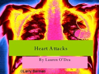 Heart Attacks By Lauren O’Dea 