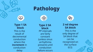 Comprehensive Overview of Heart Blocks: Classification, Diagnosis, and ...