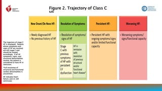 Figure 2. Trajectory of Class C
HF
21
The trajectory of stage C
HF is displayed. Patients
whose symptoms and
signs of HF are resolved
are still stage C and
should be treated
accordingly. If all HF
symptoms, signs, and
structural abnormalities
resolve, the patient is
considered to have HF in
remission.
*Full resolution of
structural and functional
cardiac abnormalities is
uncommon.
HF indicates heart
failure; and LV, left
ventricular.
 