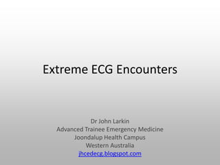 Extreme ECG Encounters
Dr John Larkin
Advanced Trainee Emergency Medicine
Joondalup Health Campus
Western Australia
jhcedecg.blogspot.com
 