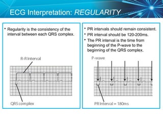 Heart-Rhythm-Interpretation-ECG-Stripllls-2012 CC_1.pptx