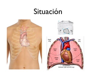 Situación
 
