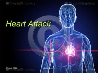 5th April 2014 Galiakot.com
Heart Attack
 