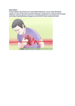 Heart attack :
A heart attack, also known as a myocardial infarction, occurs when the blood
supply to a part of the heart muscle is blocked, usually due to a blood clot.For more
visit https://heathylife4you.blogspot.com/2023/07/Heart-attack%20.html
 