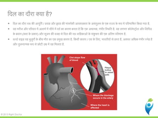 © 2013 Right Doctor
िदल का दौरा क्याहै?
 िदल का दौरा र� क� आपूितर्/ प्रवाह और �दय क� मांसपेशी आवश्यकता के असंतुलन के एक राज्य के �प में प�रभािषत िकया ग.
 यह मरीज और प�रवार में अलामर् में सीने में ददर् का कारण बनता है िक एक , गंभीर िस्थित ह. यह लगभग कोलेस्ट्रॉल और िलि
के बयान (वसा के प्रक) और सूजन क� वजह से िदल क� र� वािहकाओंके संकुचन क� एक अंितम प�रणाम है.
 वल्डर् वाइड यह बुजुग� के बीच मौत का एक प्रमुख कार. िकसी कारण / एस के िलए, भारतीयों से ग्रस्, अक्सर अिधक गंभीर स्नेह ह
और तुलनात्मक �प से छोटी उम्र में यह िमलत.
Clot stops flow
of blood
Where the blockage
occurs in the artery
Where the heart is
affected
Plaque
buildup
on vessel
walls
 