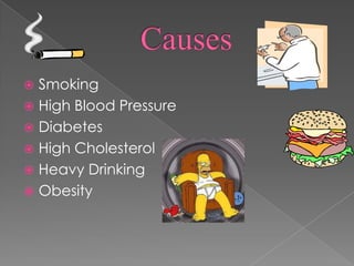 CausesSmokingHigh Blood PressureDiabetesHigh CholesterolHeavy DrinkingObesity