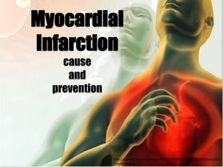 Myocardial
Infarction
    cause
     and
  prevention




               http://www.flickr.com/photos/59255719@N02/6009853308/sizes/l/in
               /photostream/
 
