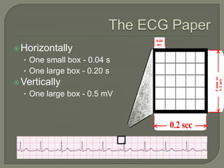  Horizontally
  • One small box - 0.04 s
  • One large box - 0.20 s
 Vertically
  • One large box - 0.5 mV
 
