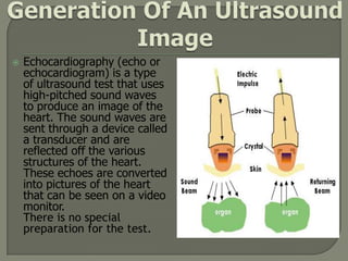    Echocardiography (echo or
    echocardiogram) is a type
    of ultrasound test that uses
    high-pitched sound waves
    to produce an image of the
    heart. The sound waves are
    sent through a device called
    a transducer and are
    reflected off the various
    structures of the heart.
    These echoes are converted
    into pictures of the heart
    that can be seen on a video
    monitor.
    There is no special
    preparation for the test.
 