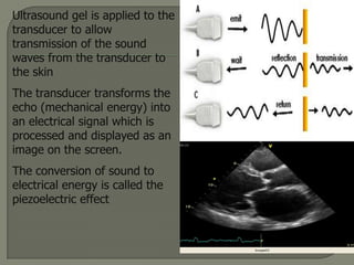 Ultrasound gel is applied to the
transducer to allow
transmission of the sound
waves from the transducer to
the skin
The transducer transforms the
echo (mechanical energy) into
an electrical signal which is
processed and displayed as an
image on the screen.
The conversion of sound to
electrical energy is called the
piezoelectric effect
 