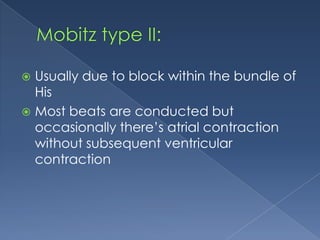Usually due to block within the bundle of
His
 Most beats are conducted but
occasionally there’s atrial contraction
without subsequent ventricular
contraction


 