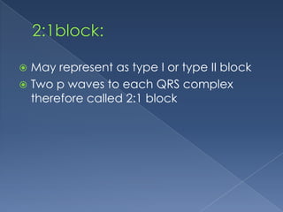 May represent as type I or type II block
 Two p waves to each QRS complex
therefore called 2:1 block


 