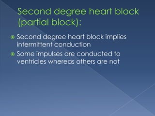 Second degree heart block implies
intermittent conduction
 Some impulses are conducted to
ventricles whereas others are not


 