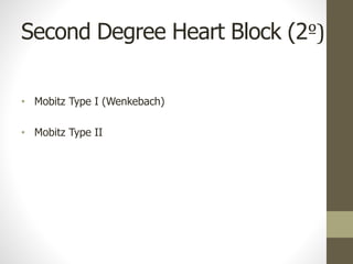 Second Degree Heart Block (2º)
• Mobitz Type I (Wenkebach)
• Mobitz Type II
 