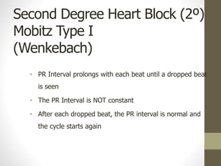 Second Degree Heart Block (2º)
Mobitz Type I
(Wenkebach)
• PR Interval prolongs with each beat until a dropped beat
is seen
• The PR Interval is NOT constant
• After each dropped beat, the PR interval is normal and
the cycle starts again
 