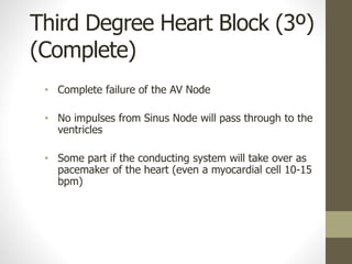 Third Degree Heart Block (3º)
(Complete)
• Complete failure of the AV Node
• No impulses from Sinus Node will pass through to the
ventricles
• Some part if the conducting system will take over as
pacemaker of the heart (even a myocardial cell 10-15
bpm)
 