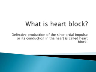 Defective production of the sino-artial impulse
or its conduction in the heart is called heart
block.
 