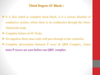 Third Degree AV Block :
 It is also called as complete heart block, it is a serious disorder of
conductive system, where there is no conduction through the Atrio-
Ventricular node.
 Complete failure of AV Node.
 No impulses from sinus node will pass through to the ventricles.
 Complete dissociation between P wave & QRS Complex, where
more P waves are seen before one QRS complex.
 