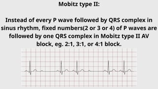 Comprehensive Overview of Heart Block Types, Causes, and Management | PPTX