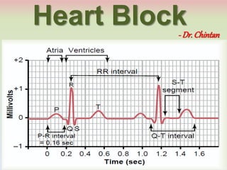Heart Block- Dr. Chintan
 