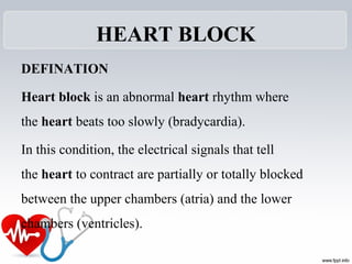 HEART BLOCK
DEFINATION
Heart block is an abnormal heart rhythm where 
the heart beats too slowly (bradycardia). 
In this condition, the electrical signals that tell 
the heart to contract are partially or totally blocked 
between the upper chambers (atria) and the lower 
chambers (ventricles).
 