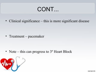 CONT...
• Clinical significance – this is more significant disease 
• Treatment – pacemaker
• Note – this can progress to 3º Heart Block
 