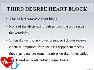 THIRD DEGREE HEART BLOCK
• Also called complete heart block,
• None of the electrical impulses from the atria reach
the ventricles.
• When the ventricles (lower chambers) do not receive
electrical impulses from the atria (upper chambers),
they may generate some impulses on their own, called
junctional or ventricular escape beats.
 