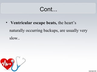 Cont...
• Ventricular escape beats, the heart’s
naturally occurring backups, are usually very
slow..
 