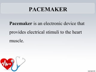 PACEMAKER
Pacemaker is an electronic device that
provides electrical stimuli to the heart
muscle.
 