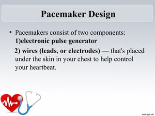Pacemaker Design
• Pacemakers consist of two components:
1)electronic pulse generator
2) wires (leads, or electrodes) — that's placed
under the skin in your chest to help control
your heartbeat.
 
