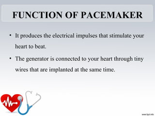 FUNCTION OF PACEMAKER
• It produces the electrical impulses that stimulate your
heart to beat.
• The generator is connected to your heart through tiny
wires that are implanted at the same time.
 