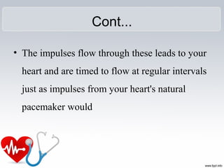 Cont...
• The impulses flow through these leads to your
heart and are timed to flow at regular intervals
just as impulses from your heart's natural
pacemaker would
 