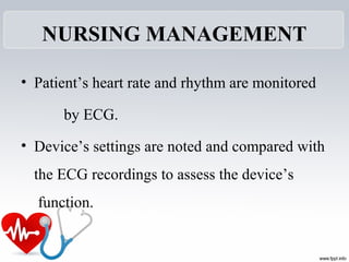 NURSING MANAGEMENT
• Patient’s heart rate and rhythm are monitored
by ECG.
• Device’s settings are noted and compared with
the ECG recordings to assess the device’s
function.
 