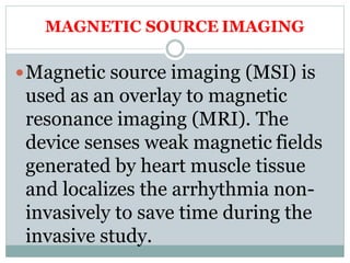 MAGNETIC SOURCE IMAGING
Magnetic source imaging (MSI) is
used as an overlay to magnetic
resonance imaging (MRI). The
device senses weak magnetic fields
generated by heart muscle tissue
and localizes the arrhythmia non-
invasively to save time during the
invasive study.
 