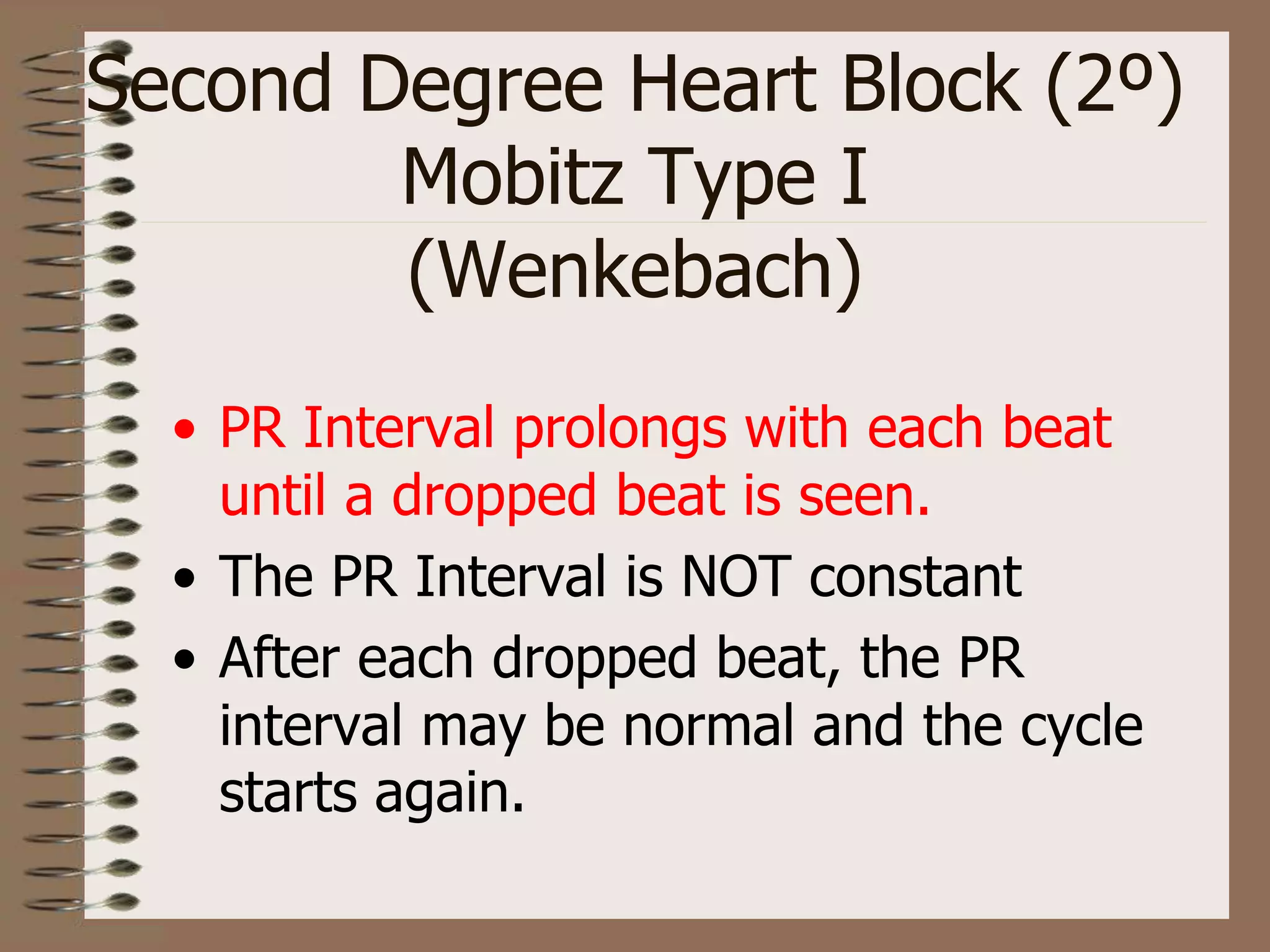 Second Degree Heart Block (2º)
Mobitz Type I
(Wenkebach)
• PR Interval prolongs with each beat
until a dropped beat is seen.
• The PR Interval is NOT constant
• After each dropped beat, the PR
interval may be normal and the cycle
starts again.
 