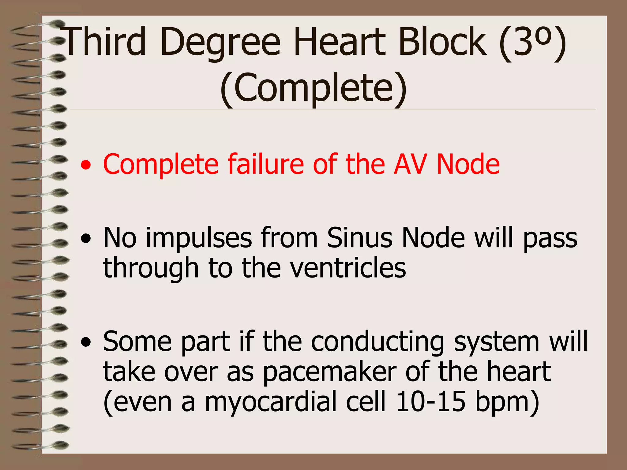 Third Degree Heart Block (3º)
(Complete)
• Complete failure of the AV Node
• No impulses from Sinus Node will pass
through to the ventricles
• Some part if the conducting system will
take over as pacemaker of the heart
(even a myocardial cell 10-15 bpm)
 