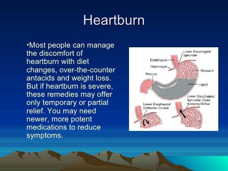 Heartburn