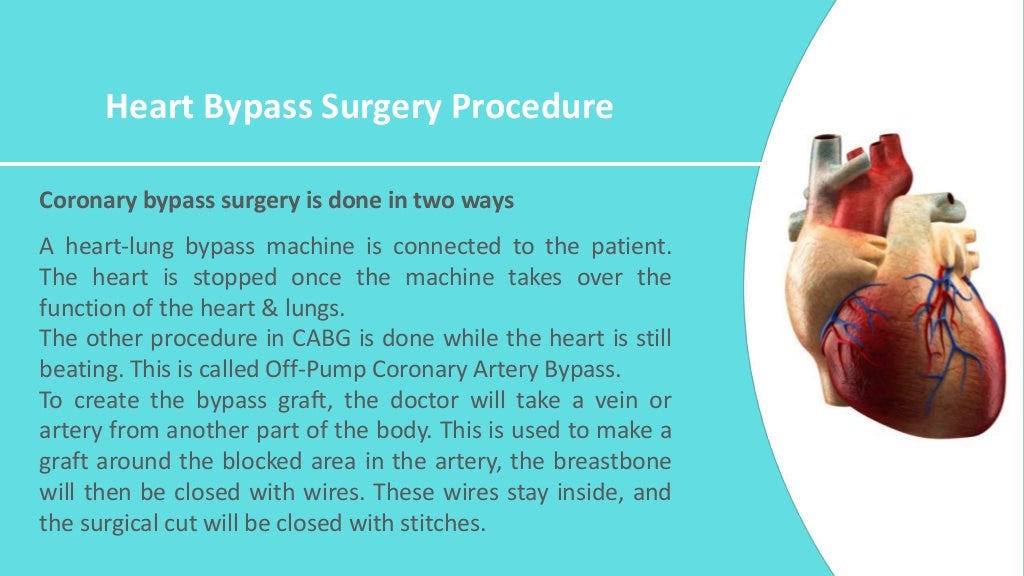Heart bypass surgery in India Heart bypass surgery cost in India CABG